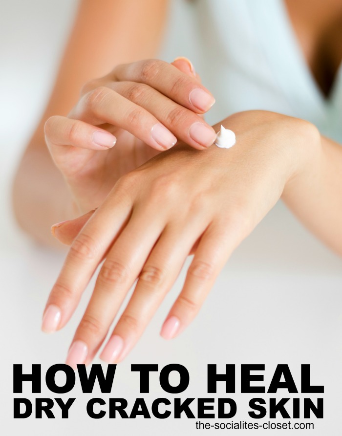 How to Heal Dry Cracked Skin at Home