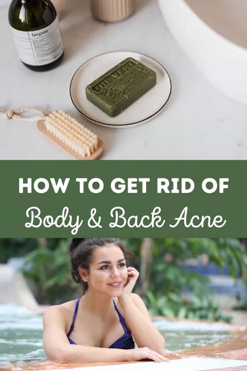 Best Soap for Body Acne on Your Back